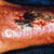 thumbnail image of Kaposi sarcoma