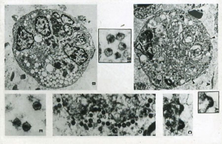 hiv virus under microscope